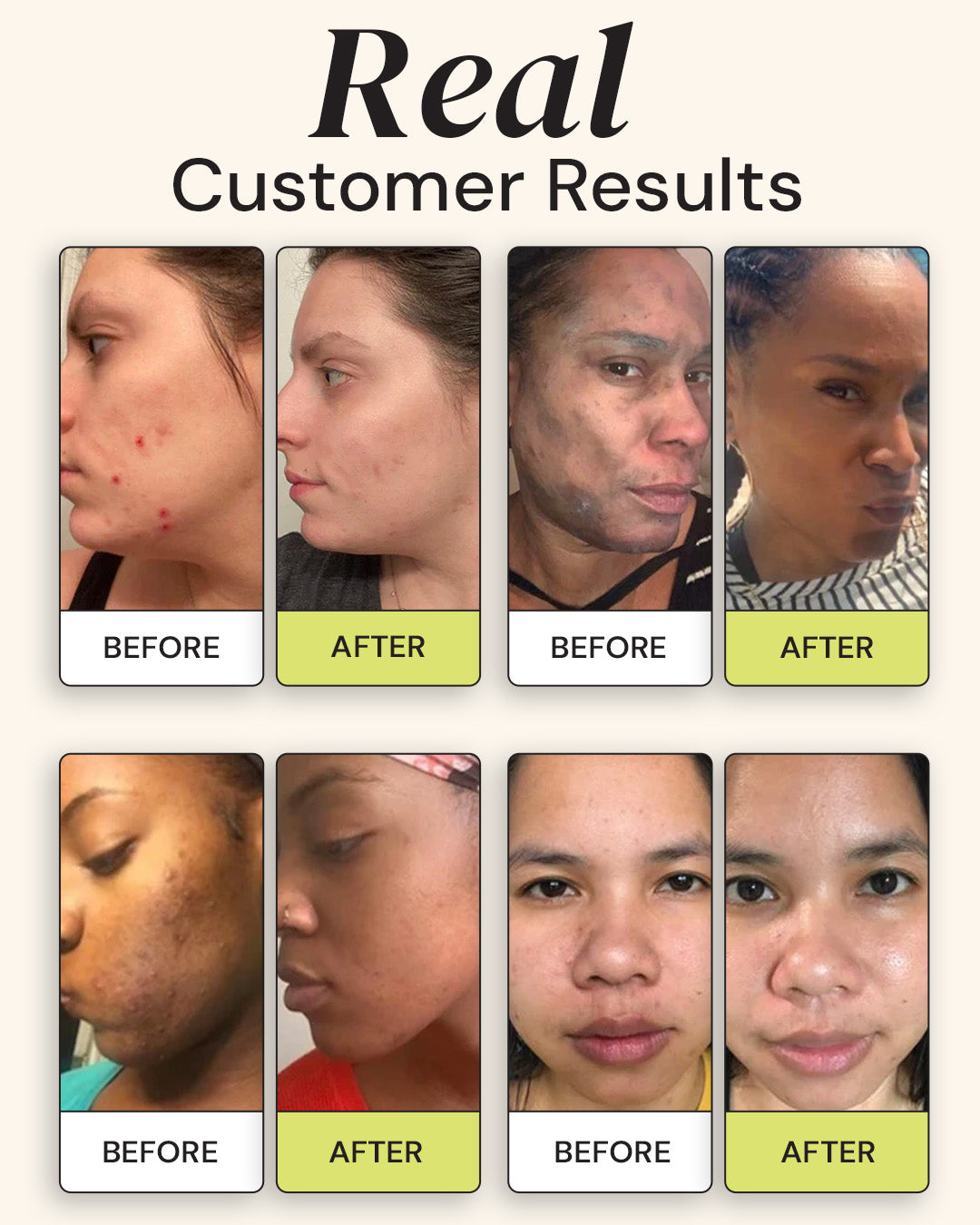 Advanced Brightening Moisturizer