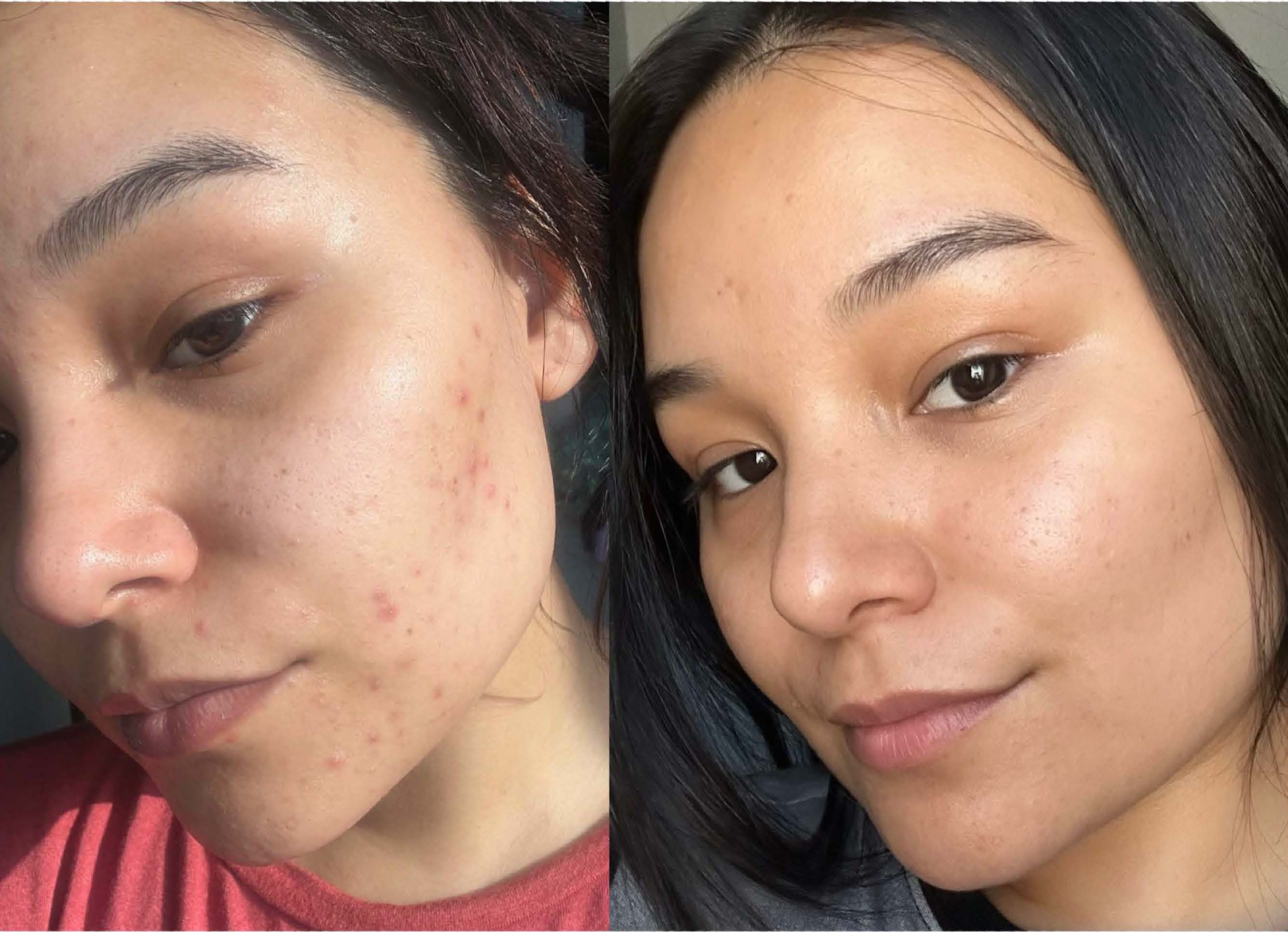 Lucent - Dramatic Brightening Potion