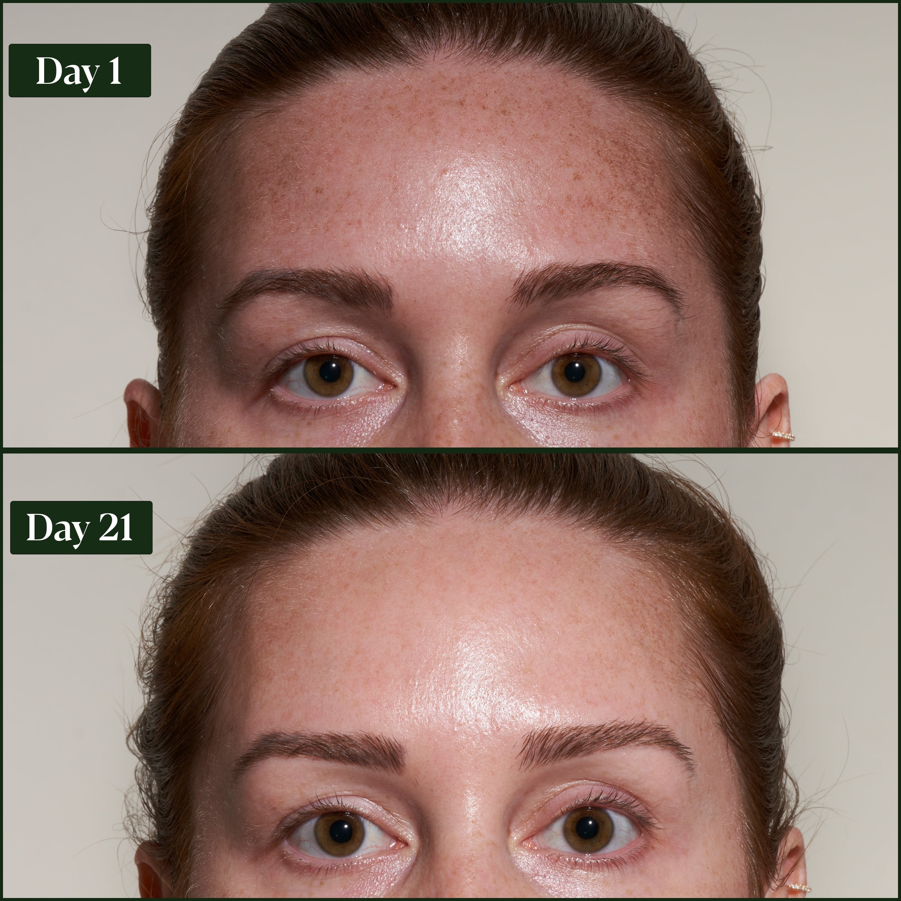(Glyco-Biotic)™ Ultra-Synbiotic Face Mask