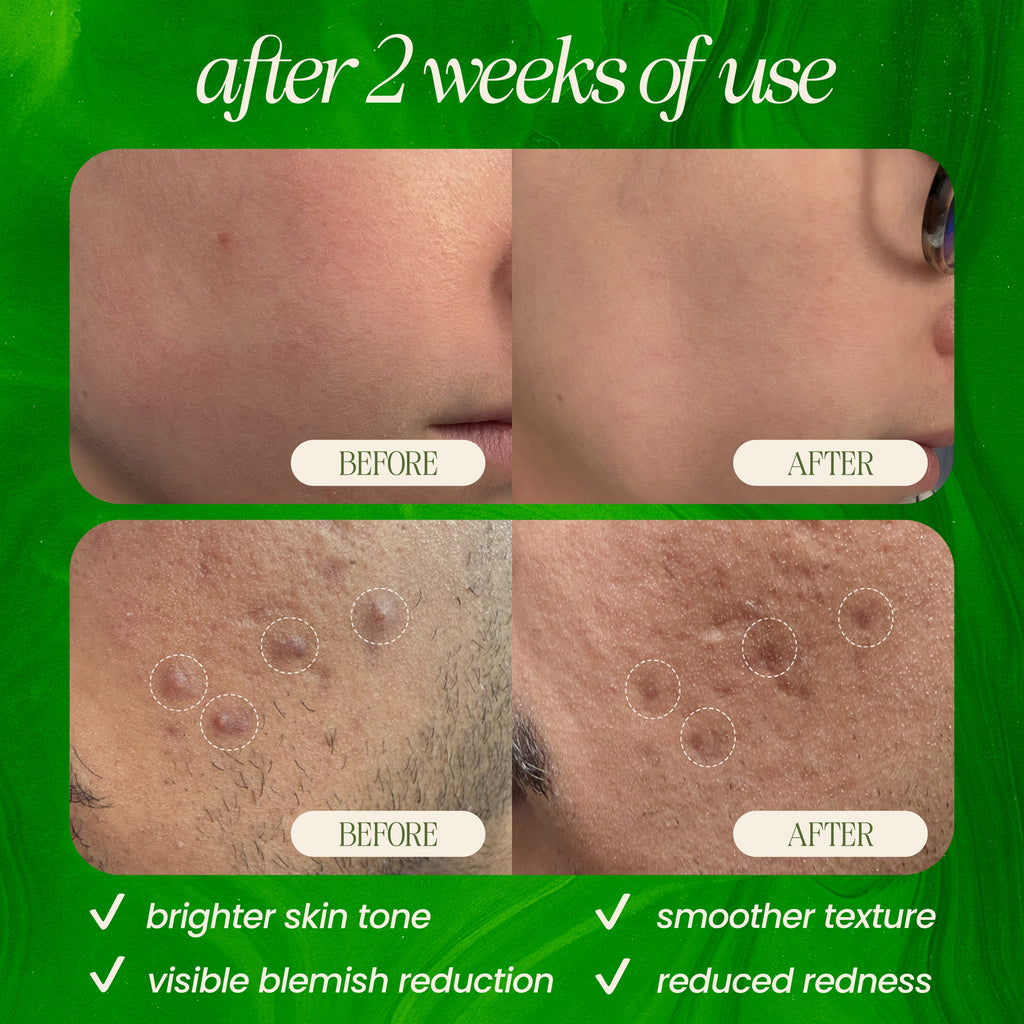Bamboo Microdermabrasion Exfoliating Cleanser