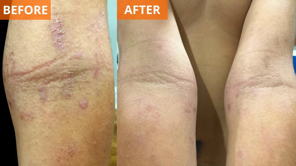 Moisturizing Body Lotion