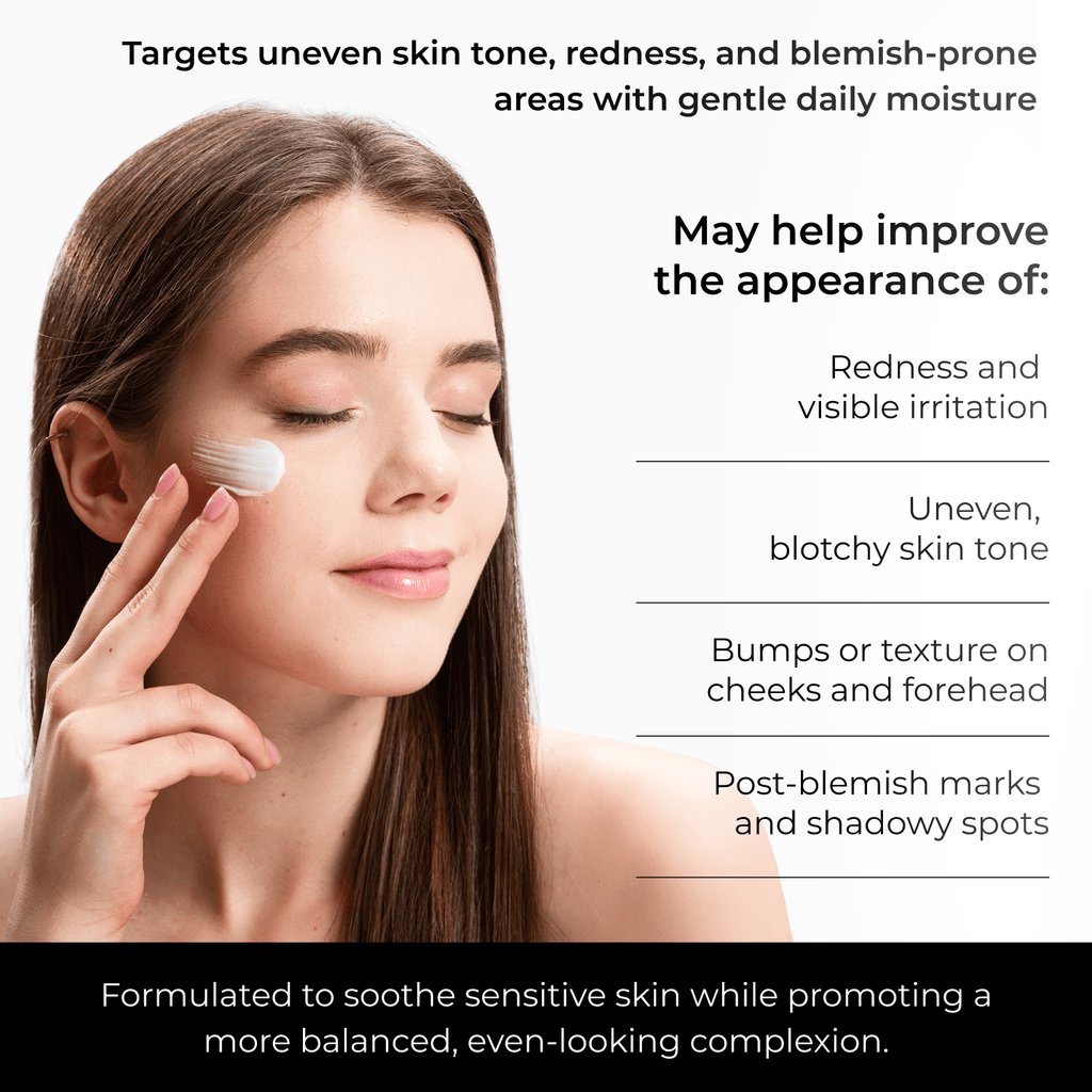 Azelaic Acid Cream