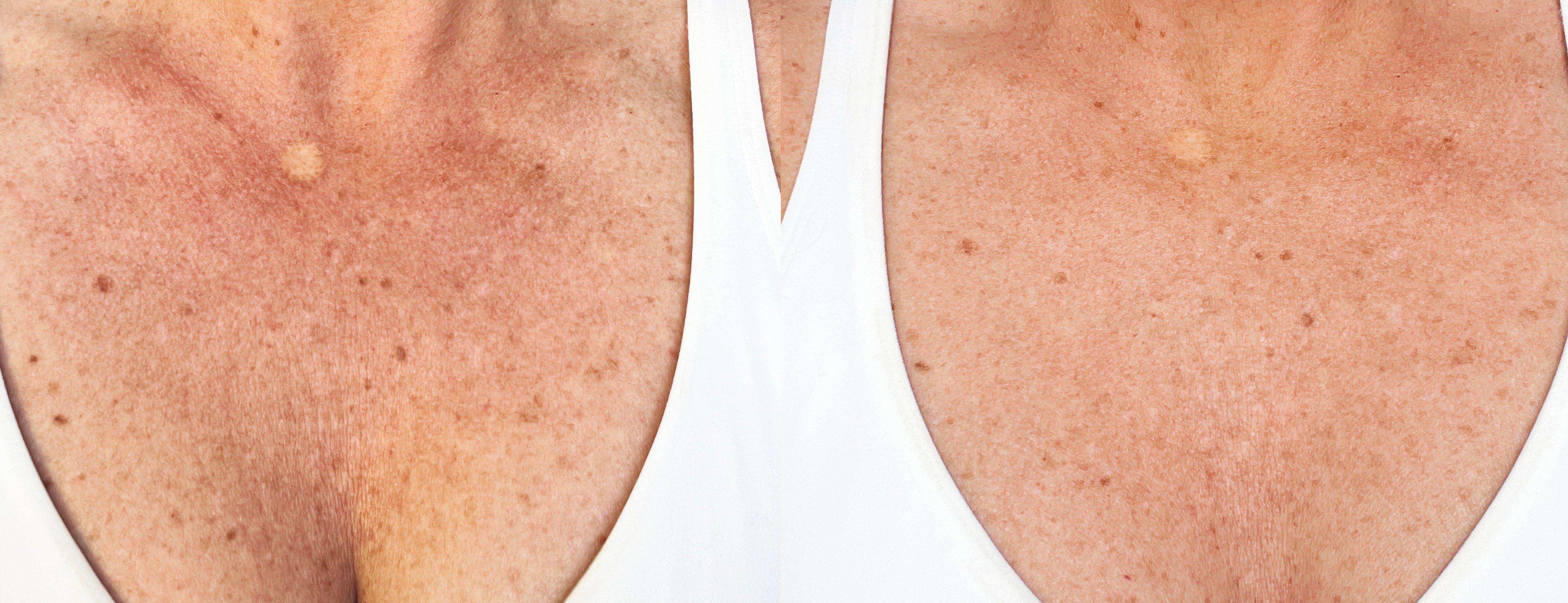 Lucent - Dramatic Brightening Potion