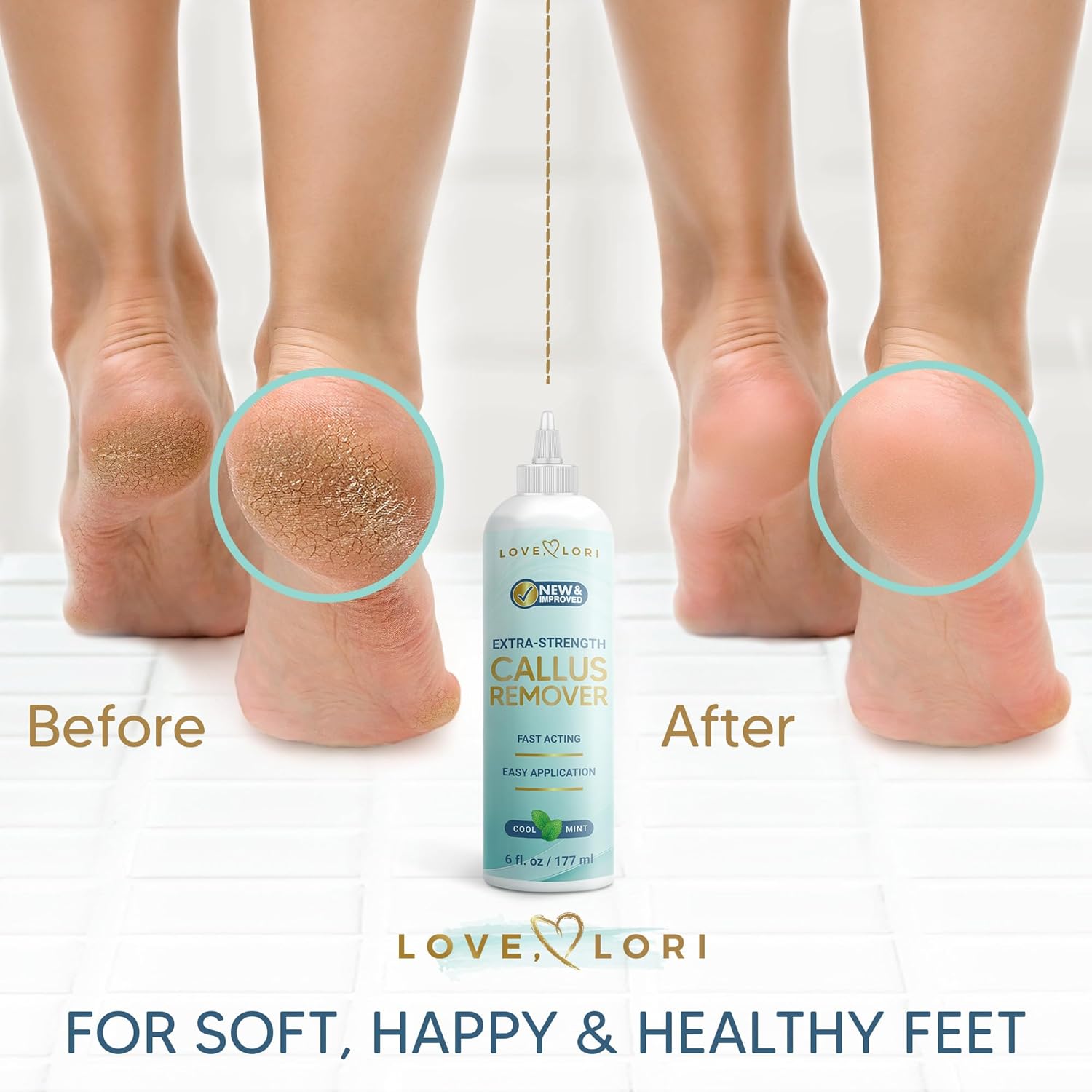 Callus Remover for Feet (Extra Strength) Foot Callus Remover Gel - Feet Scrubber, Pedicure Spa Tools, 6oz