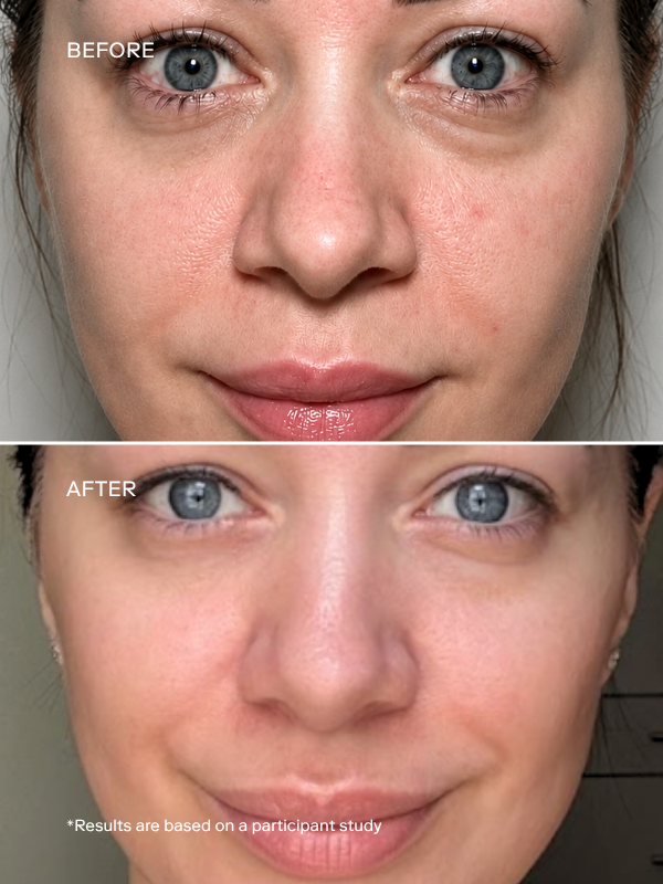 EXO ELITE™ Skin Longevity Serum