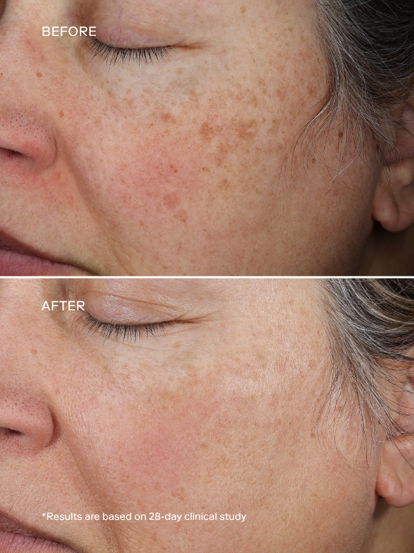 EXO PLUS® Anti-Aging Cream