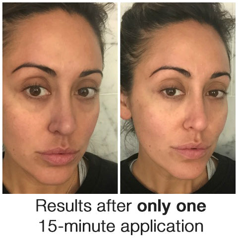 Insight Collagen Eye Treatment Masks