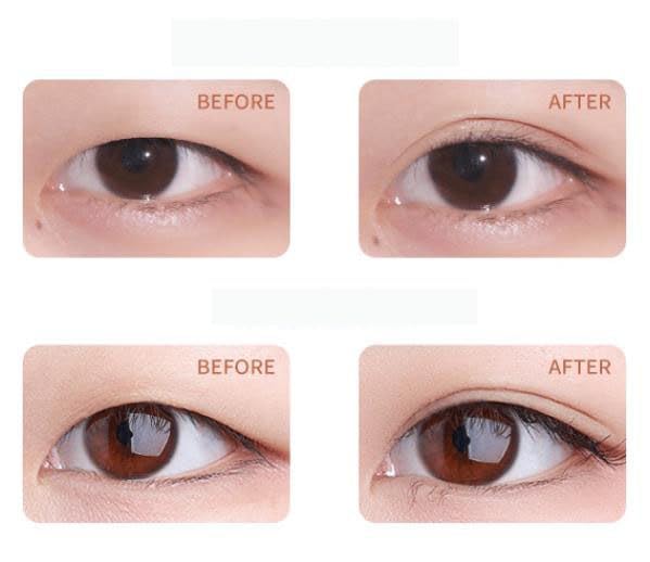 Generalizy Eyelid Tape,Satvee Waterproof Double Eyelid Tapes,Invisible Eye Lifting Strips,Satvee Lids Lift Strips,Satvee Waterproof Double Eyelid Tapes,Double Eyelid Tape Invisible (M/Crescent)