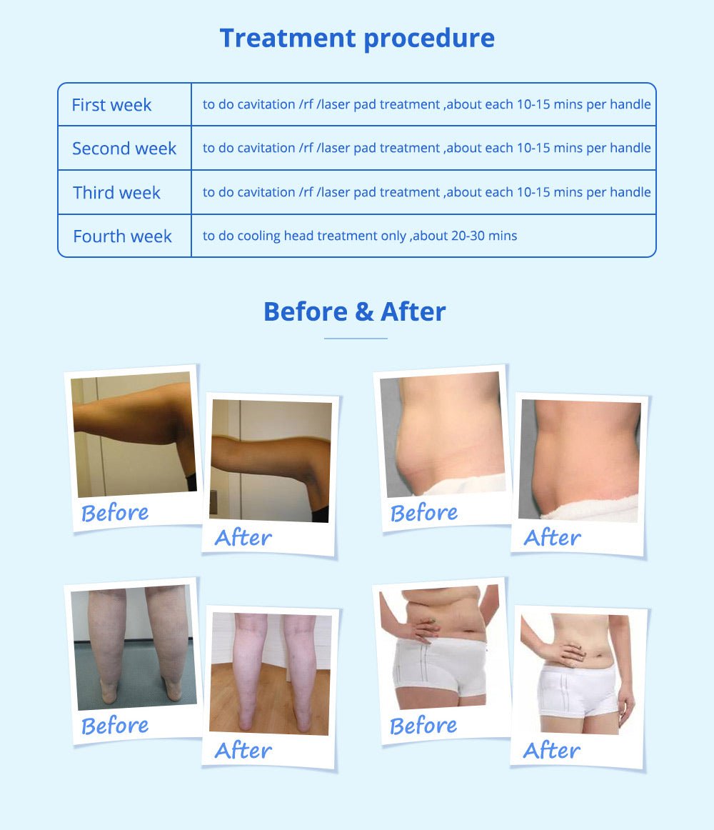 Shape Tactics 5-in-1 Cavitation Cryolipolysis Lipo Laser System