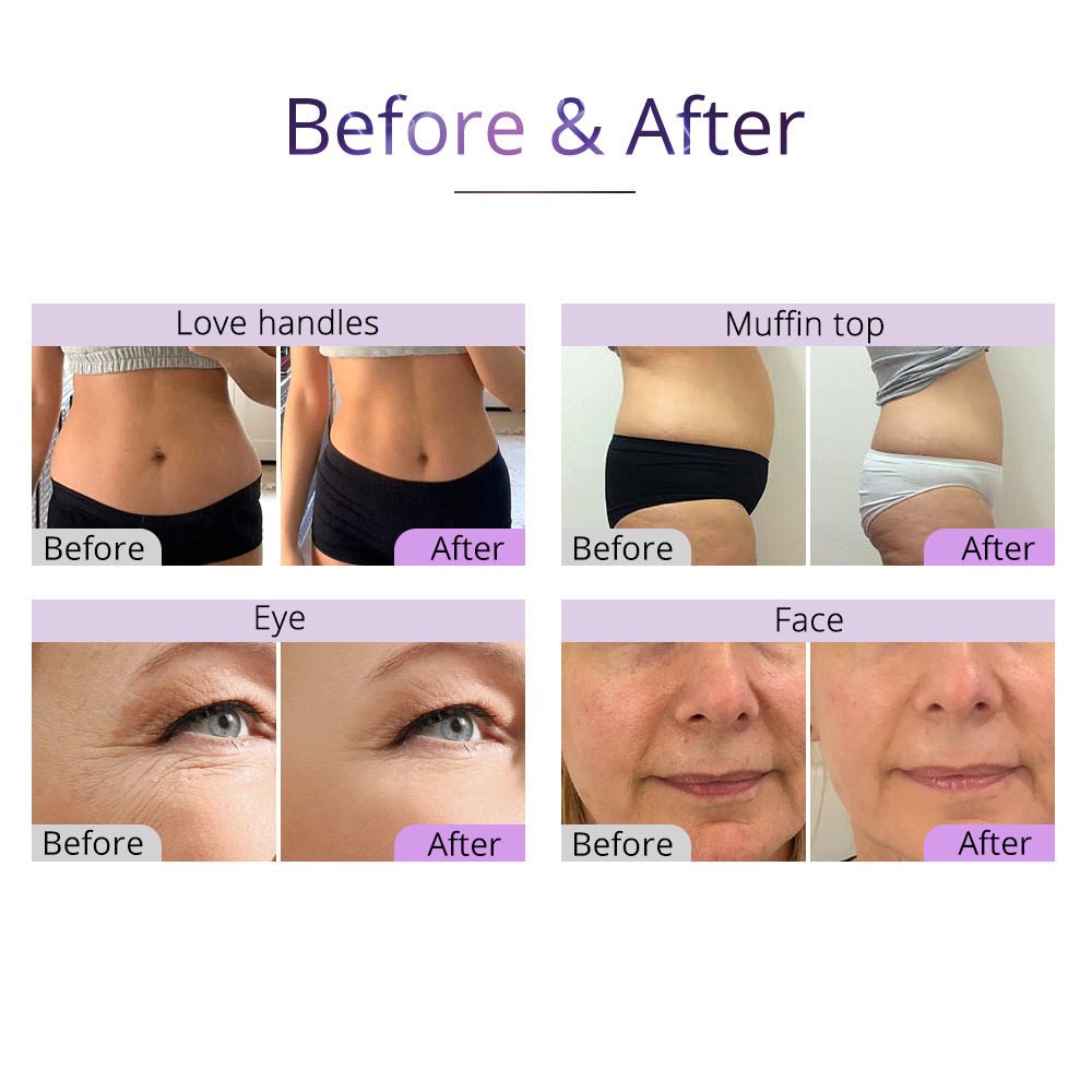 Shape Tactics 5-in-1 Cavitation Vacuum RF Body Contouring System