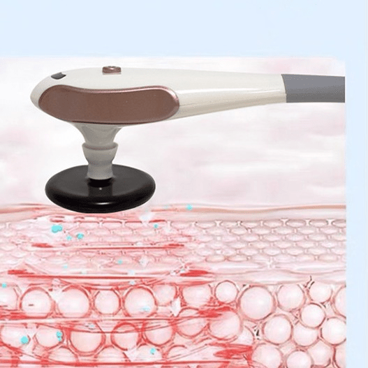 Shape Tactics Advanced Monopolar RF Diathermy System