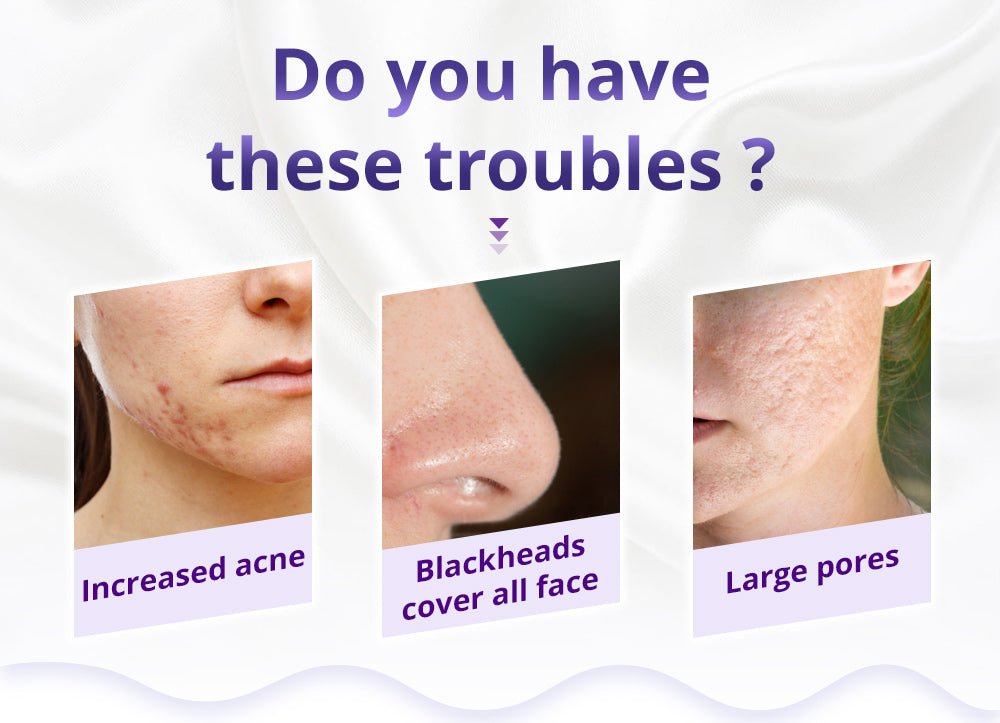 Shape Tactics Diamond Microdermabrasion & Hydrating Mist System